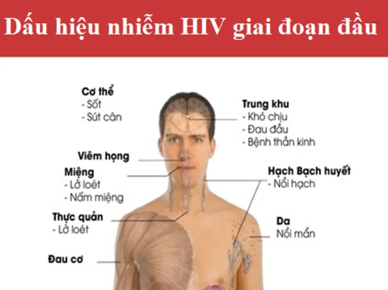 Một số biểu hiện sớm của HIV có thể giống cảm cúm, như sốt, mệt mỏi, đau họng hoặc nổi hạch.