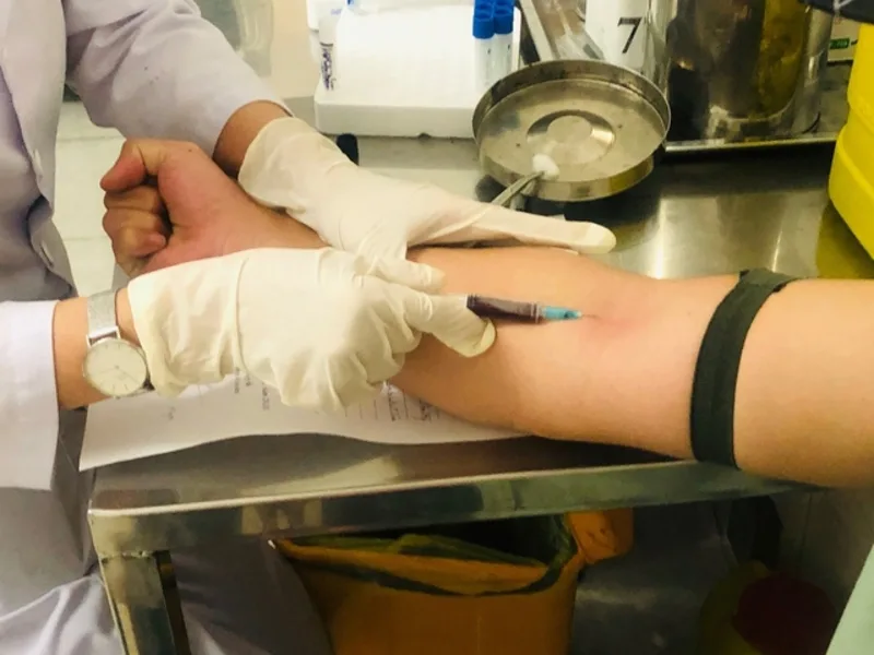 Người từng có hành vi nguy cơ nên chủ động xét nghiệm HIV để bảo vệ bản thân và người khác.
