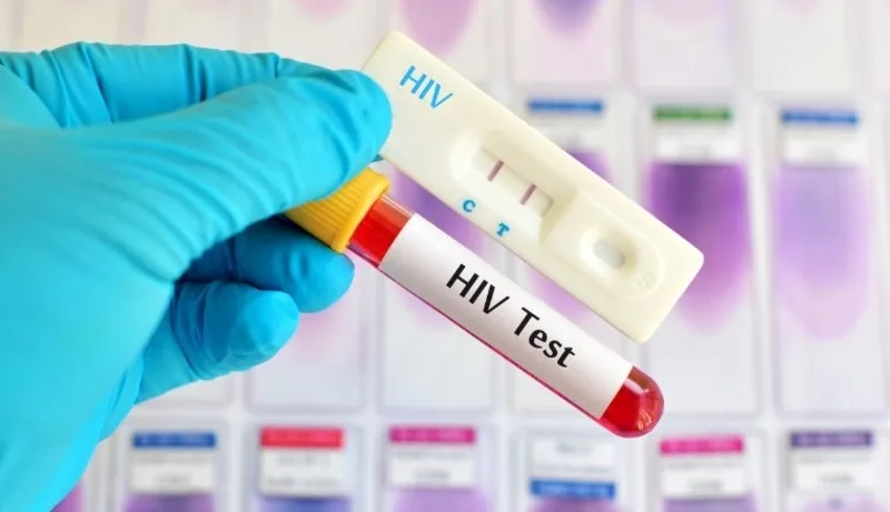 Nếu từng có nguy cơ phơi nhiễm HIV, bạn nên đi khám hoặc tư vấn y tế càng sớm càng tốt.